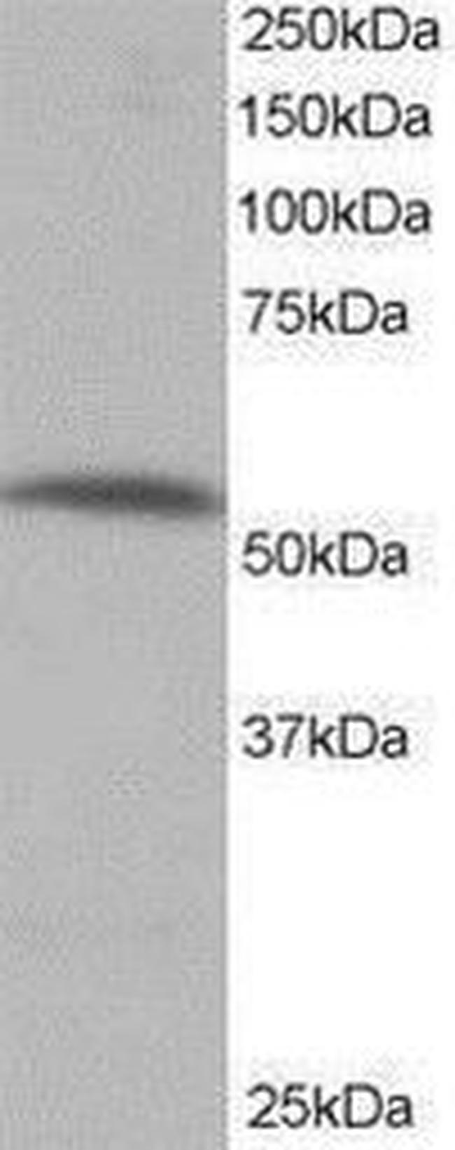 PPP2R5A Antibody in Western Blot (WB)