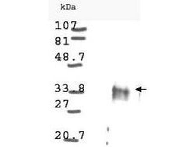 Cyclin D1 Antibody in Western Blot (WB)