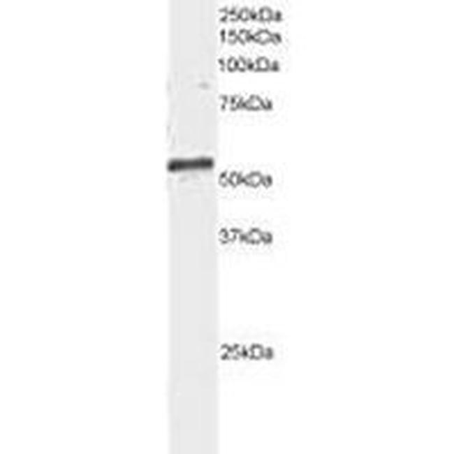 ARFGAP3 Antibody in Western Blot (WB)