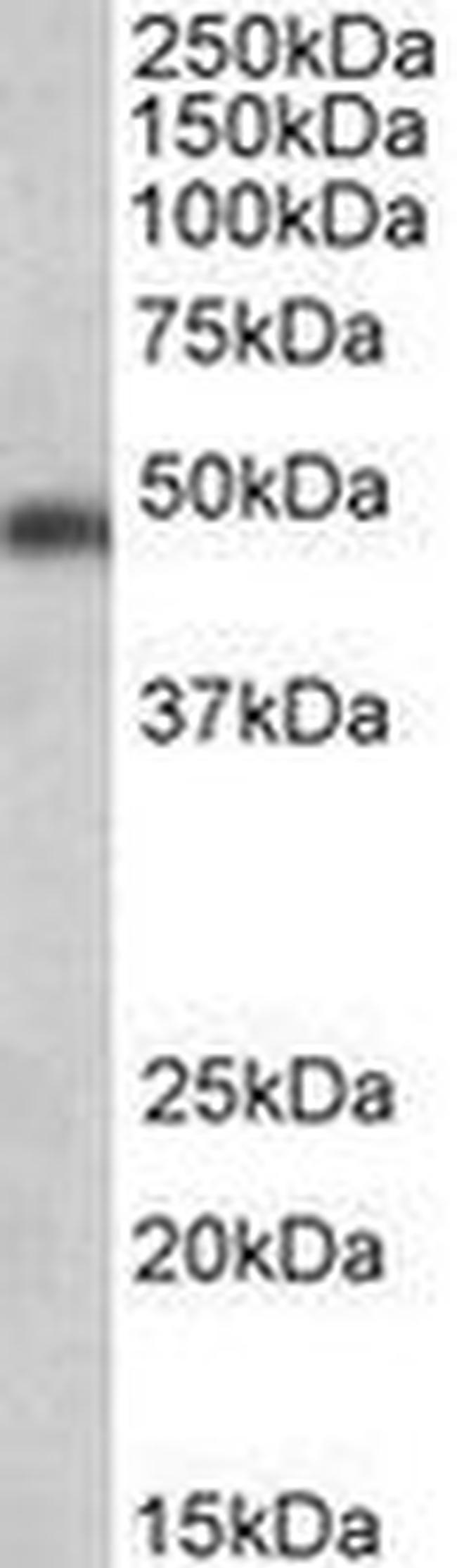 SEC61A1 Antibody in Western Blot (WB)