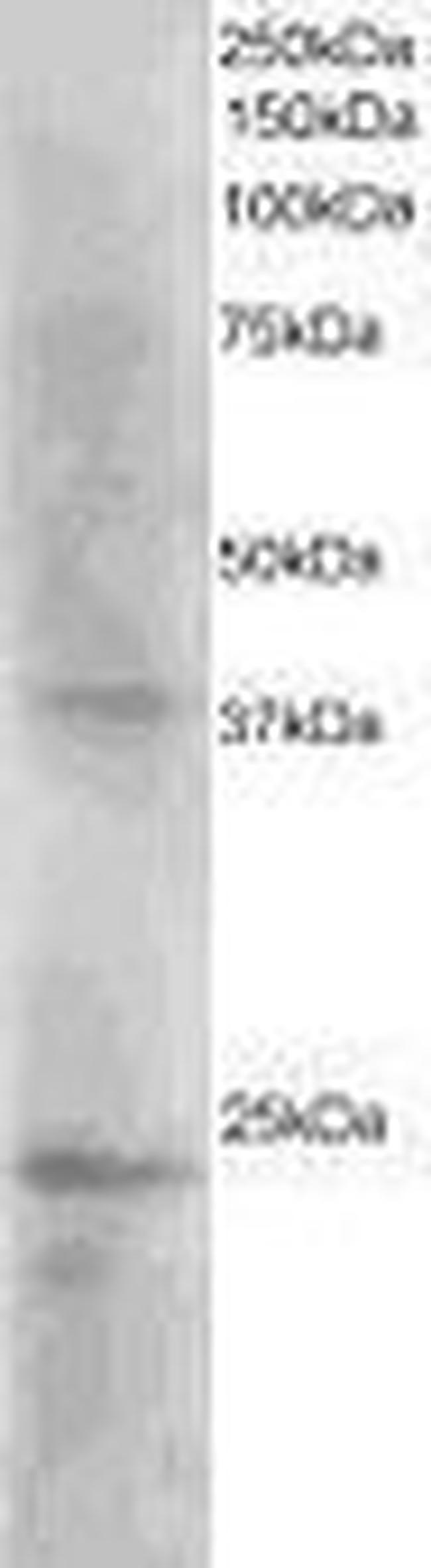 SET Antibody in Western Blot (WB)