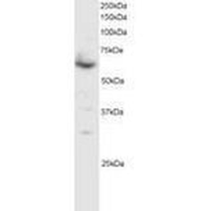 SMAD4 Antibody in Western Blot (WB)