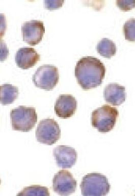 ADAM17 Antibody in Immunocytochemistry (ICC/IF)