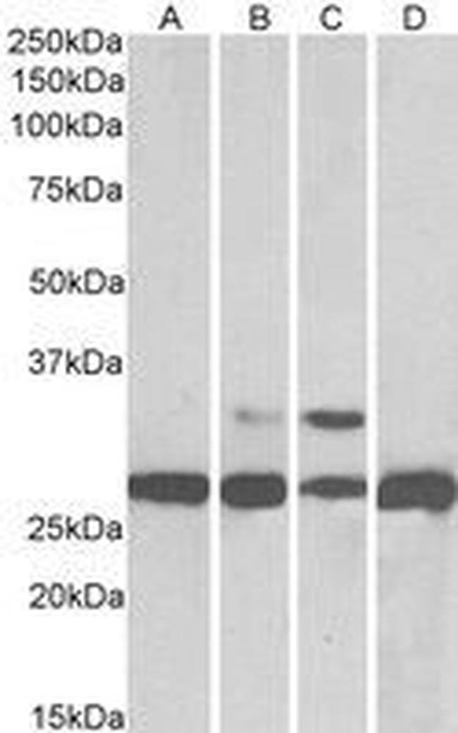 PGAM1 Antibody in Western Blot (WB)