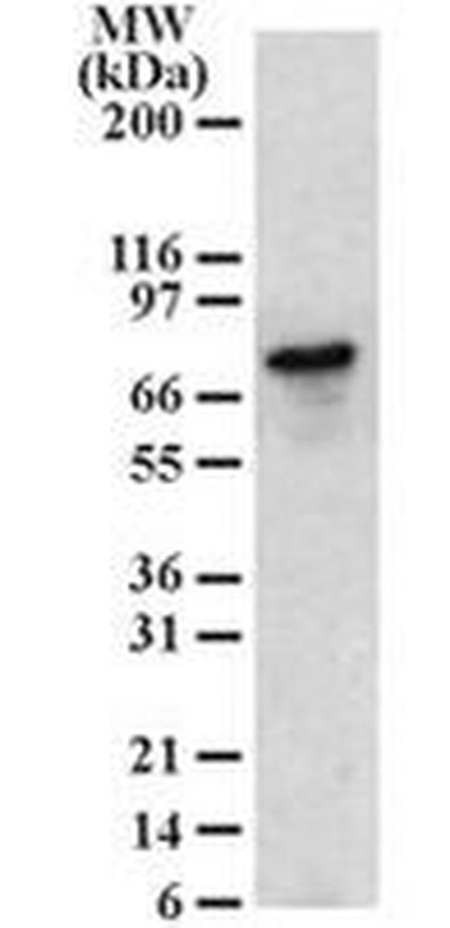 BLNK Antibody in Western Blot (WB)