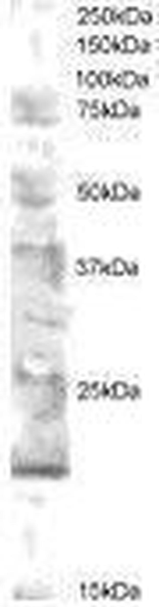 UBE2V2 Antibody in Western Blot (WB)