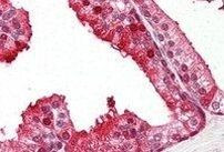 PEBP1 Antibody in Immunohistochemistry (Paraffin) (IHC (P))