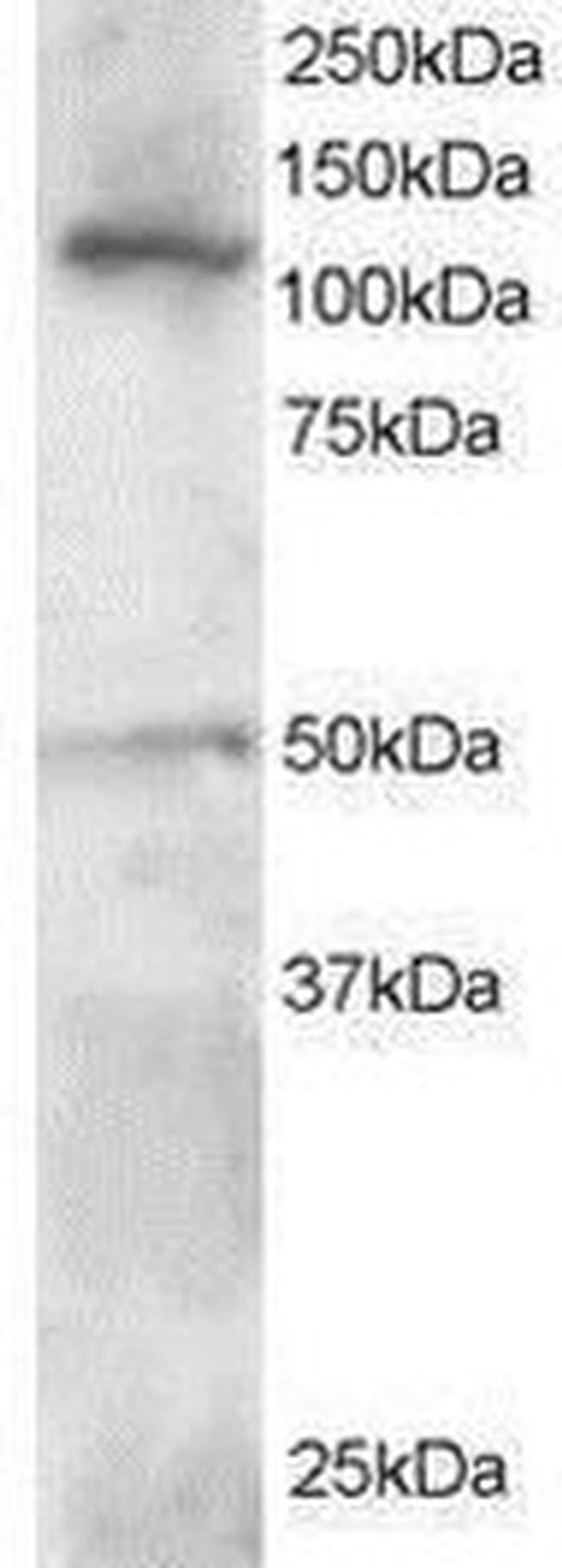 HLTF Antibody in Western Blot (WB)