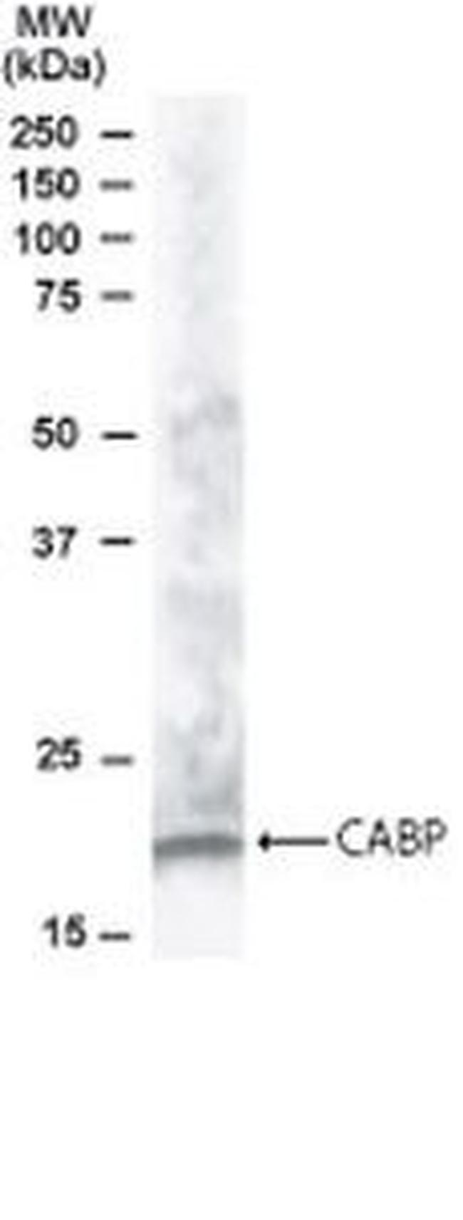 CABP1 Antibody in Western Blot (WB)