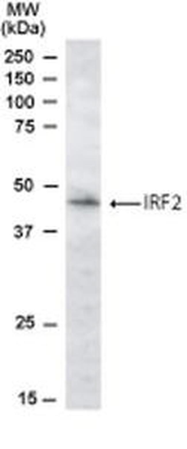 IRF2 Antibody in Western Blot (WB)