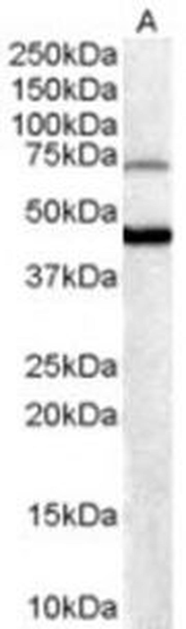 FOXG1 Antibody in Western Blot (WB)