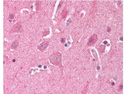 LDB2 Antibody in Immunohistochemistry (Paraffin) (IHC (P))