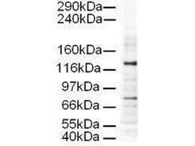 AP3D1 Antibody in Western Blot (WB)