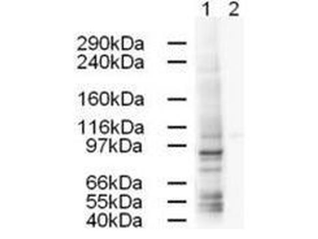 gamma Adaptin Antibody in Western Blot (WB)