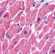 ALS2CR2 Antibody in Immunohistochemistry (Paraffin) (IHC (P))