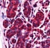 ALS2CR1 Antibody in Immunohistochemistry (Paraffin) (IHC (P))