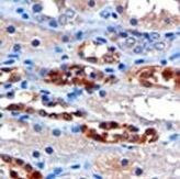 CBR1 Antibody in Immunohistochemistry (Paraffin) (IHC (P))