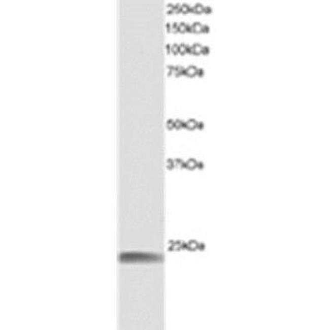 HSPB8 Antibody in Western Blot (WB)