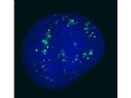 PCSK2 Antibody in Immunocytochemistry (ICC/IF)