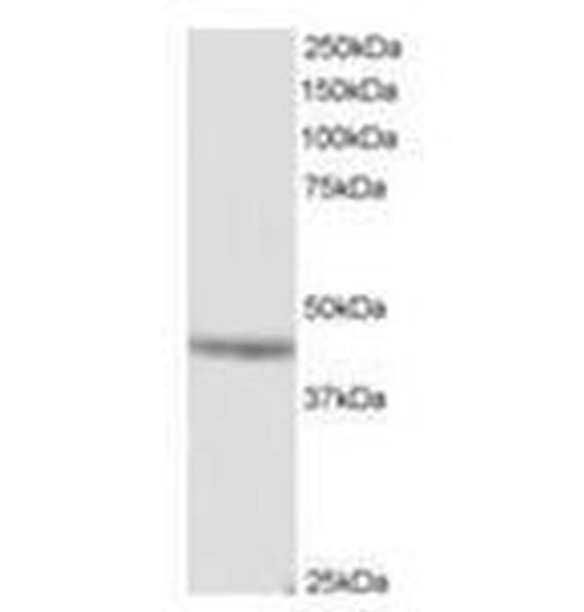 MURF3 Antibody in Western Blot (WB)
