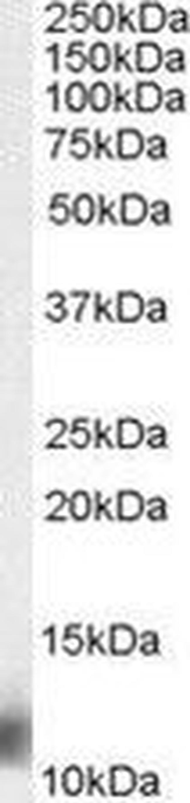 MPS1 Antibody in Western Blot (WB)