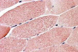 RNF90 Antibody in Immunohistochemistry (Paraffin) (IHC (P))