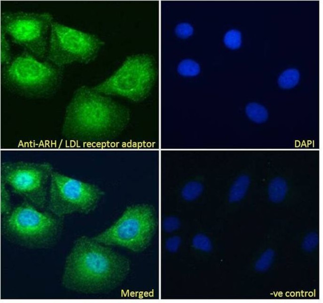LDLRAP1 Antibody in Immunocytochemistry (ICC/IF)