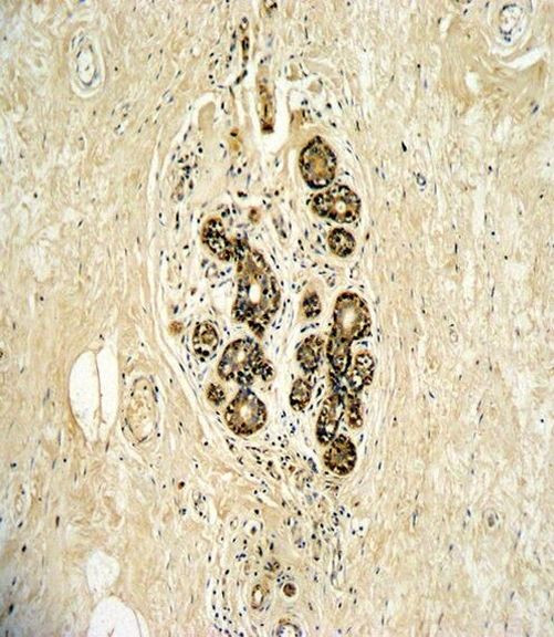 ErbB3 Antibody in Immunohistochemistry (Paraffin) (IHC (P))