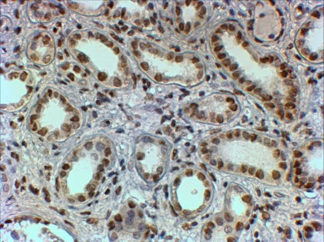 PTBP1 Antibody in Immunohistochemistry (Paraffin) (IHC (P))