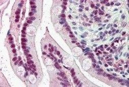 KPNA4 Antibody in Immunohistochemistry (Paraffin) (IHC (P))
