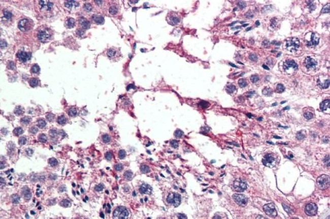RanBP16 Antibody in Immunohistochemistry (Paraffin) (IHC (P))