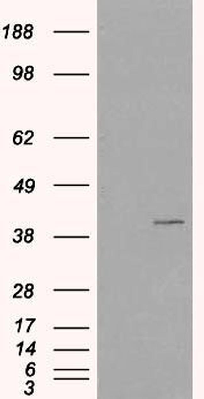 VPS26A Antibody in Western Blot (WB)