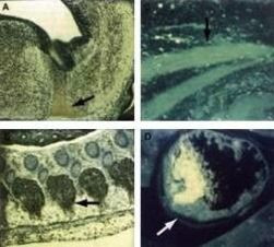 CDK9 Antibody in Immunohistochemistry (Paraffin) (IHC (P))