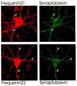 Frequenin Antibody in Immunocytochemistry (ICC/IF)