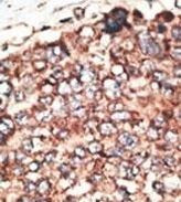 MMP17 Antibody in Immunohistochemistry (Paraffin) (IHC (P))