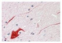 SHP2 Antibody in Immunohistochemistry (Paraffin) (IHC (P))