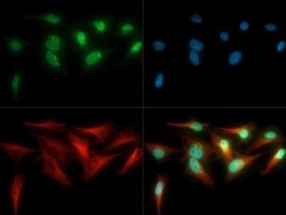 Tankyrase Antibody in Immunocytochemistry (ICC/IF)