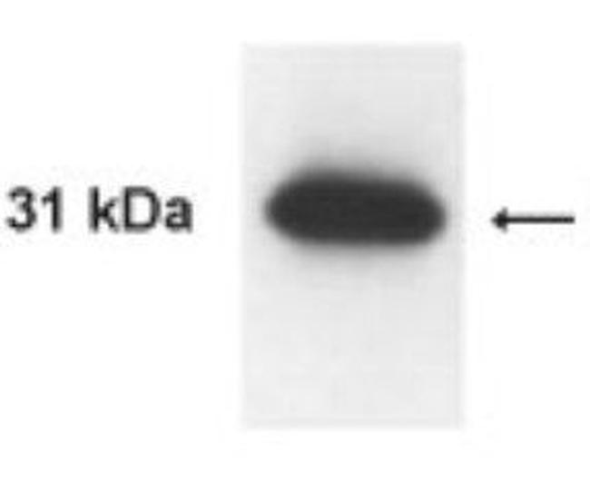 Kallikrein 13 Antibody in Western Blot (WB)
