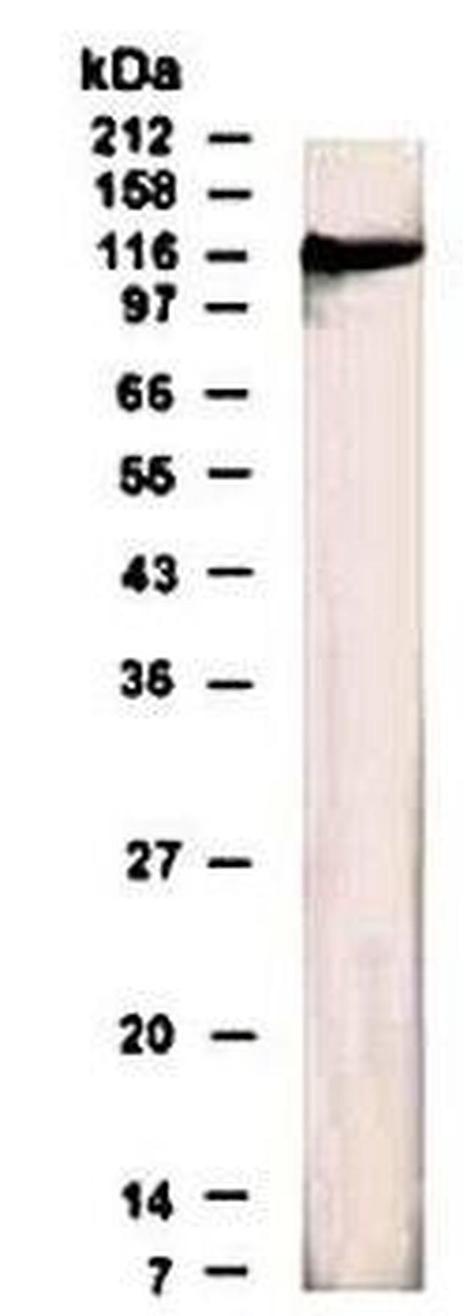 GABBR1 Antibody in Western Blot (WB)