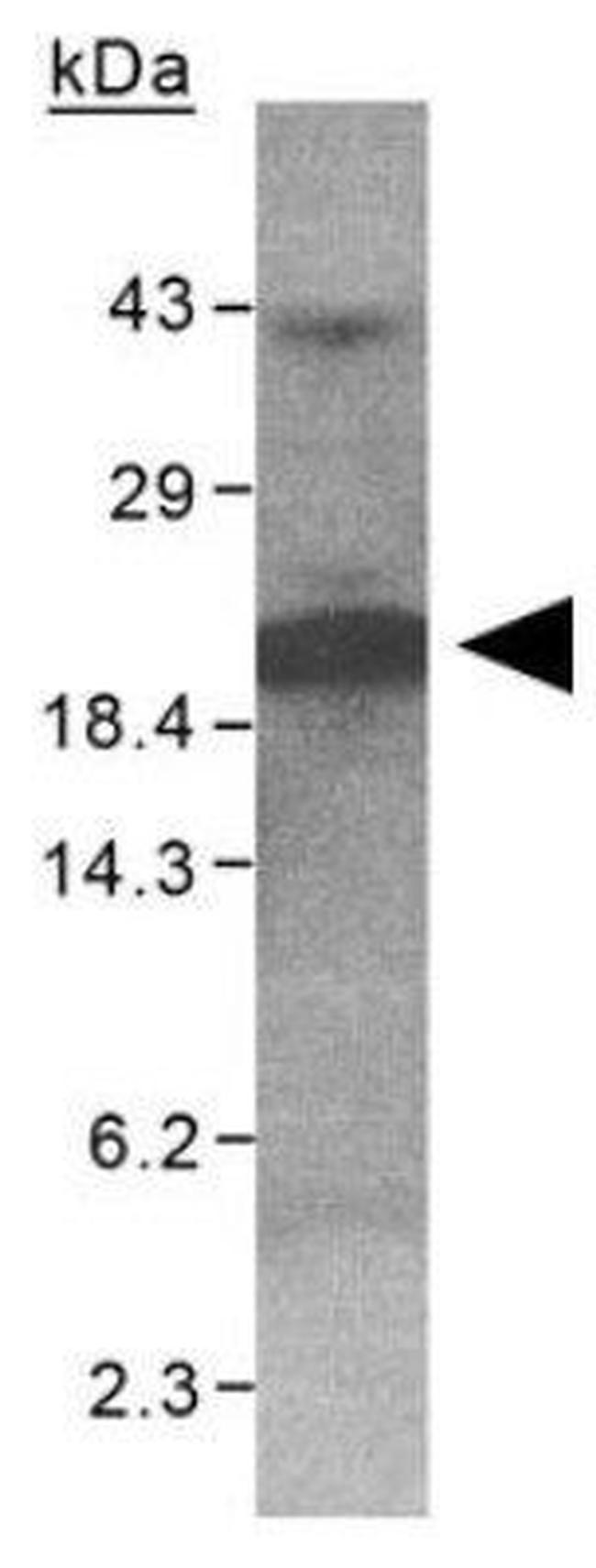 XAGE1 Antibody in Western Blot (WB)