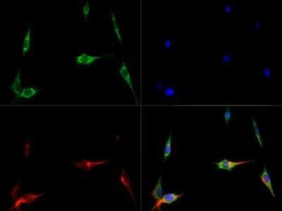 DNMT3B Antibody in Immunocytochemistry (ICC/IF)