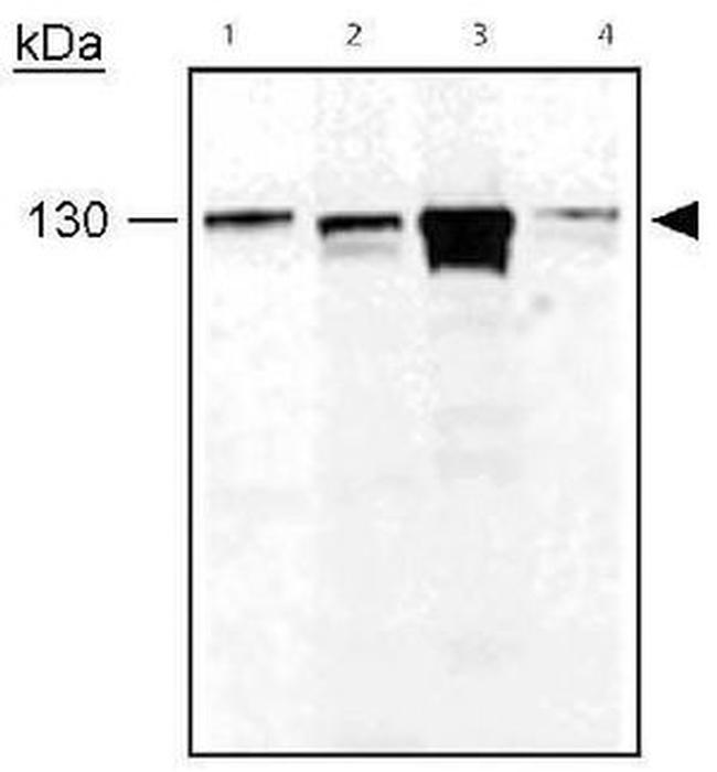 BRIP1 Antibody in Western Blot (WB)