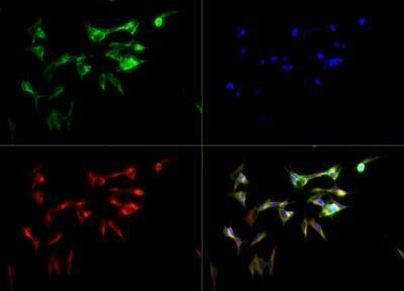 CYP46A1 Antibody in Immunocytochemistry (ICC/IF)