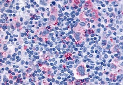 CYSLTR1 Antibody in Immunohistochemistry (Paraffin) (IHC (P))