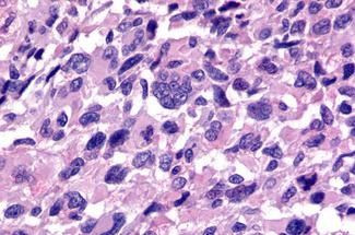 RXFP3 Antibody in Immunohistochemistry (Paraffin) (IHC (P))