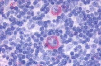 GPCR ORF4 Antibody in Immunohistochemistry (Paraffin) (IHC (P))