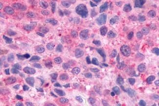 Opsin 3 Antibody in Immunohistochemistry (Paraffin) (IHC (P))