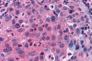 GPRC5C Antibody in Immunohistochemistry (Paraffin) (IHC (P))