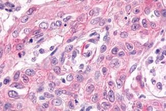 GPR17 Antibody in Immunohistochemistry (Paraffin) (IHC (P))