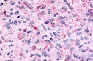 MTNR1B Antibody in Immunohistochemistry (Paraffin) (IHC (P))